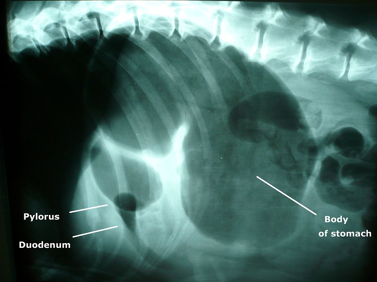 Röntgenbild einer Magendrehung
